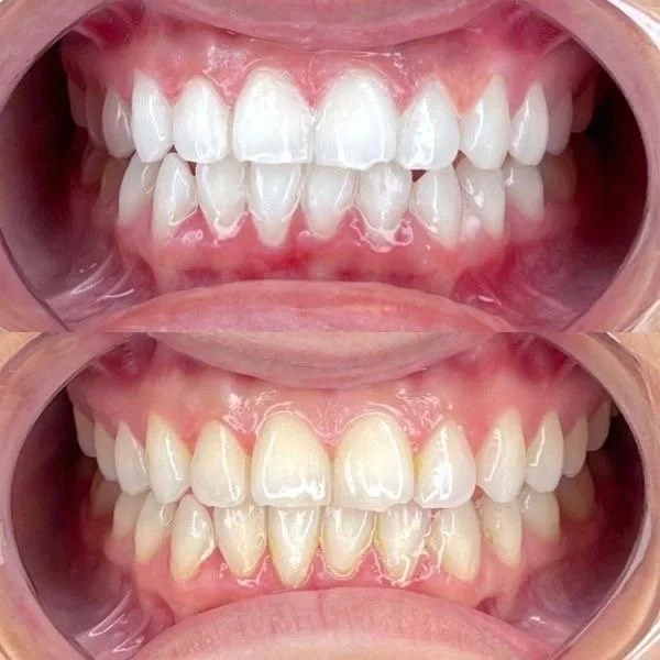 Professional Teeth Whitening &amp; Scaling and Polishing in Nad Al Hamar, Dubai