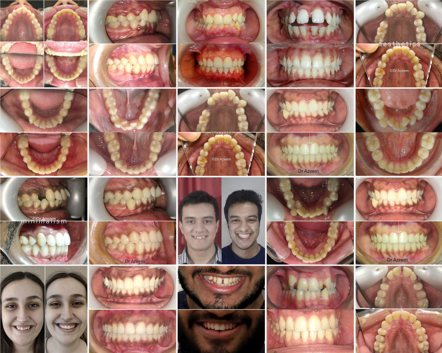 A collage of dental photos showing various angles of people's teeth and mouths, along with two smiling individuals.
