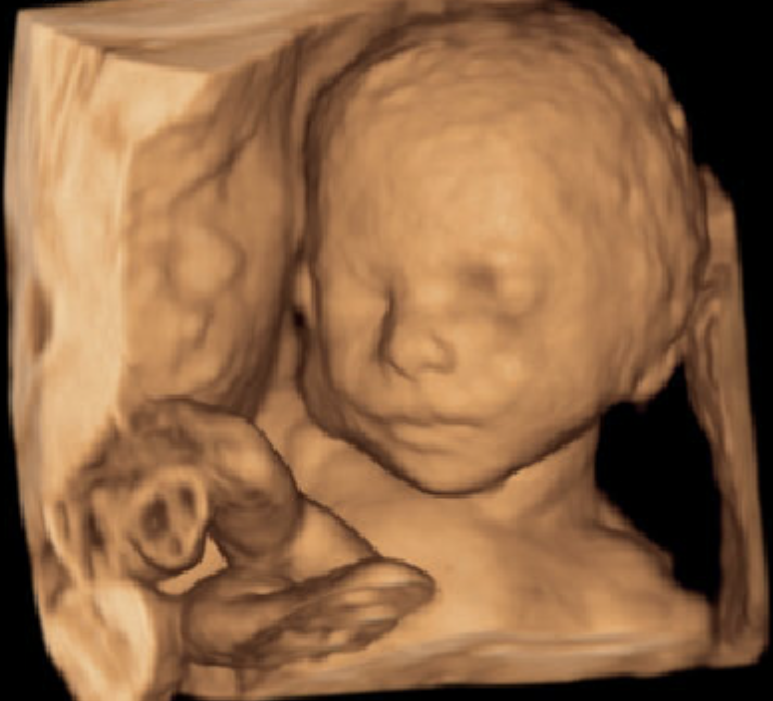 Its A Boy 3d Ultrasound