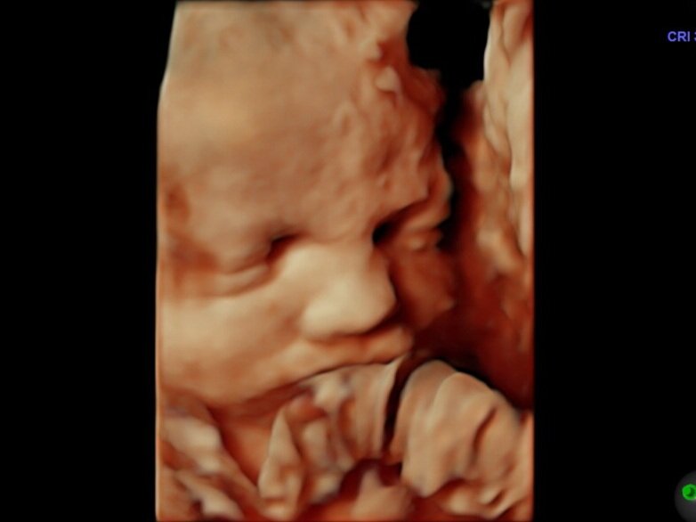 4d baby scan pictures