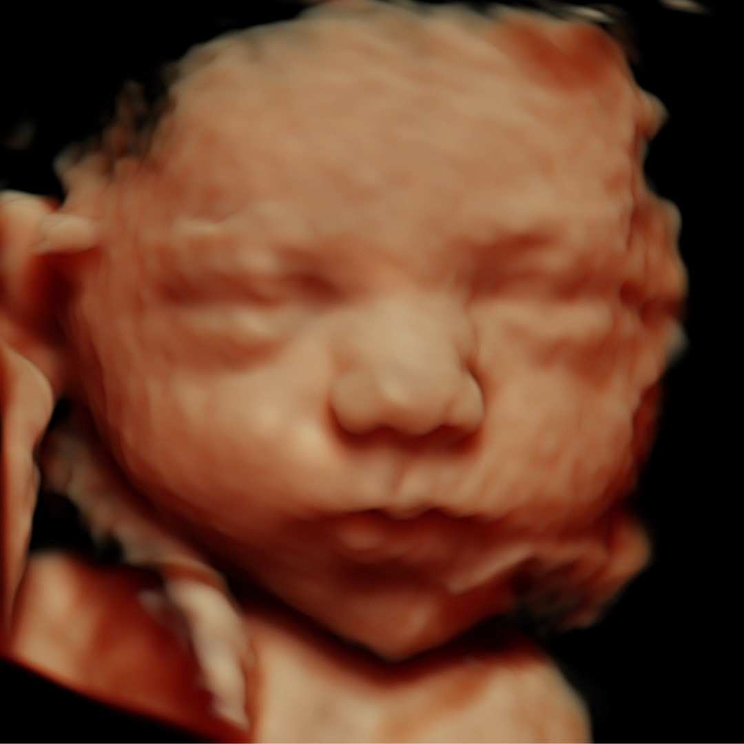 Untitled design (5).png