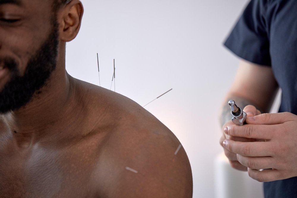 Expert Dry Needling