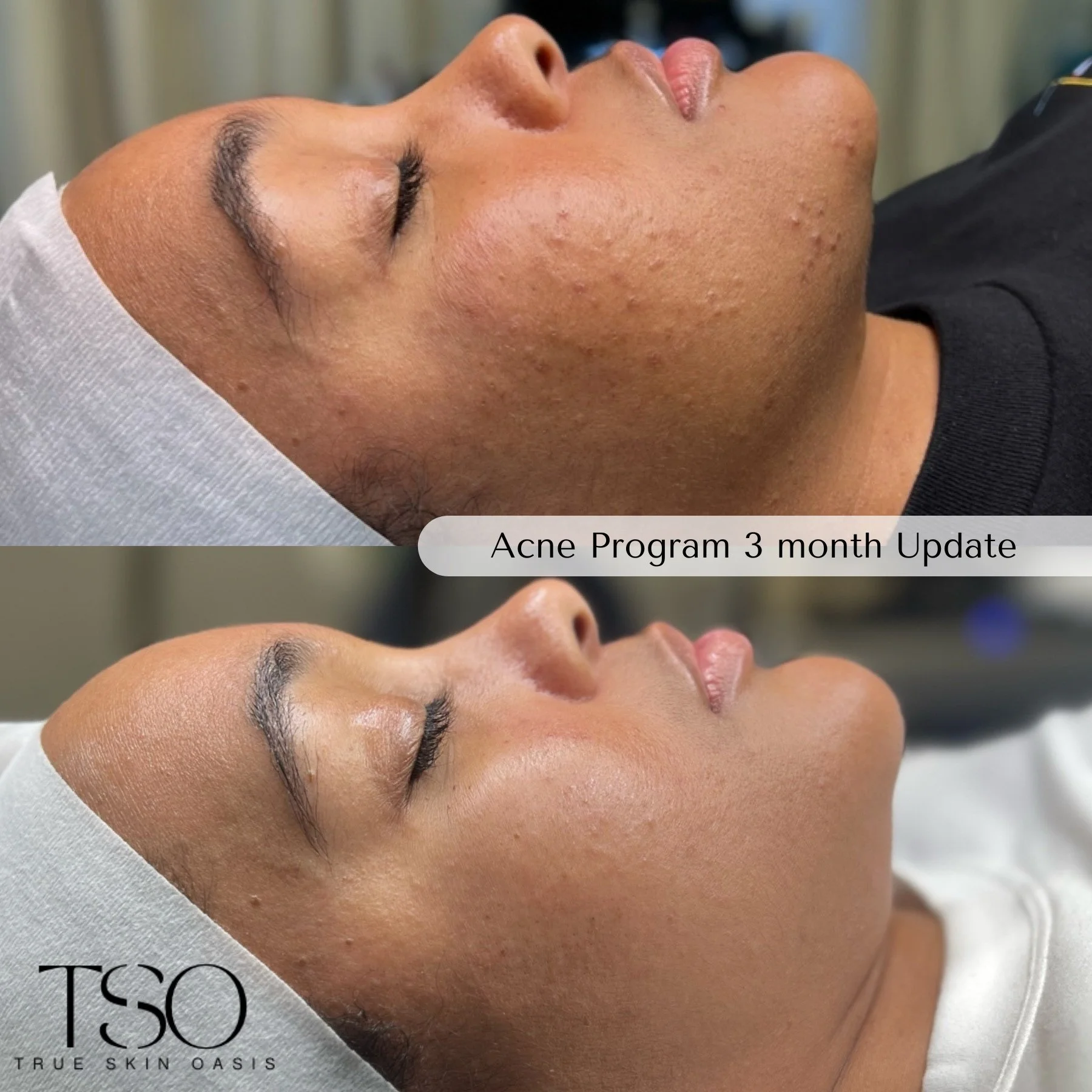 True Skin Oasis