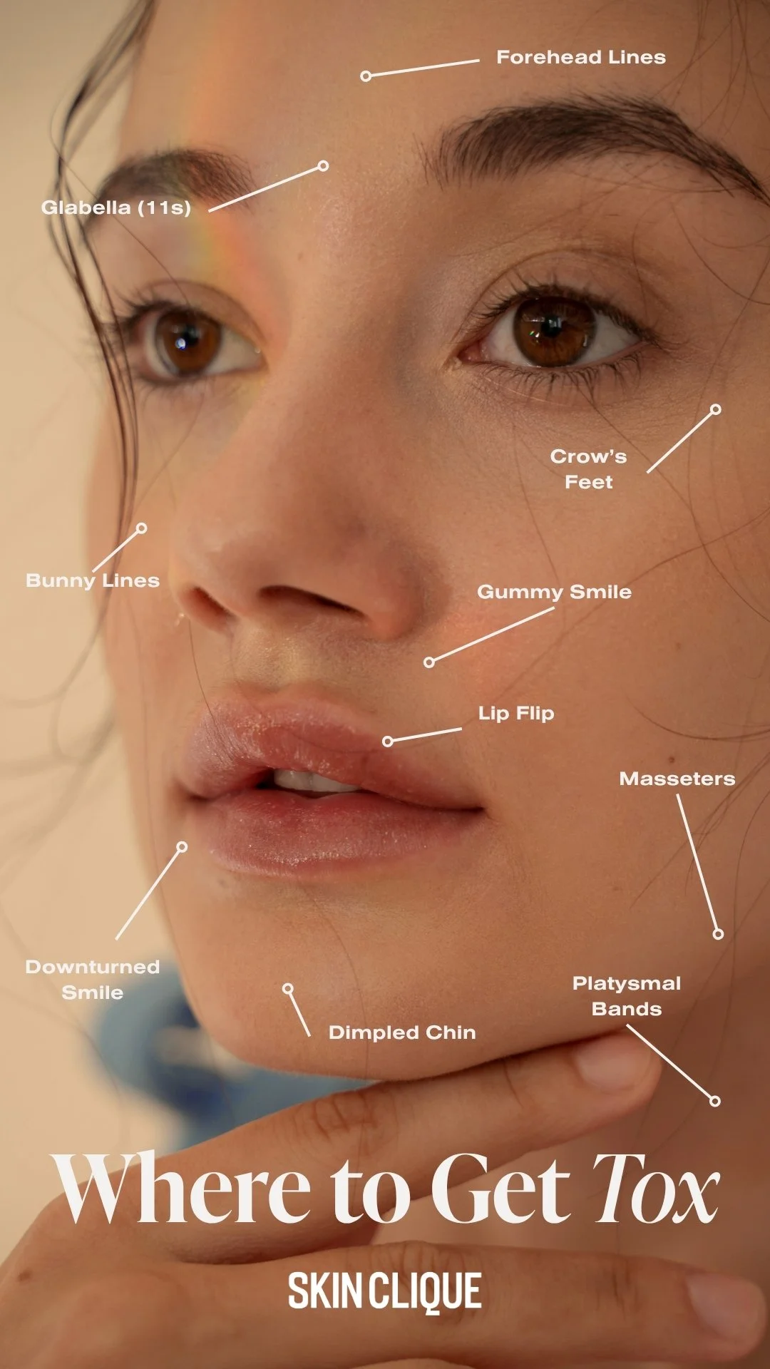 tox treatment areas - story.jpg