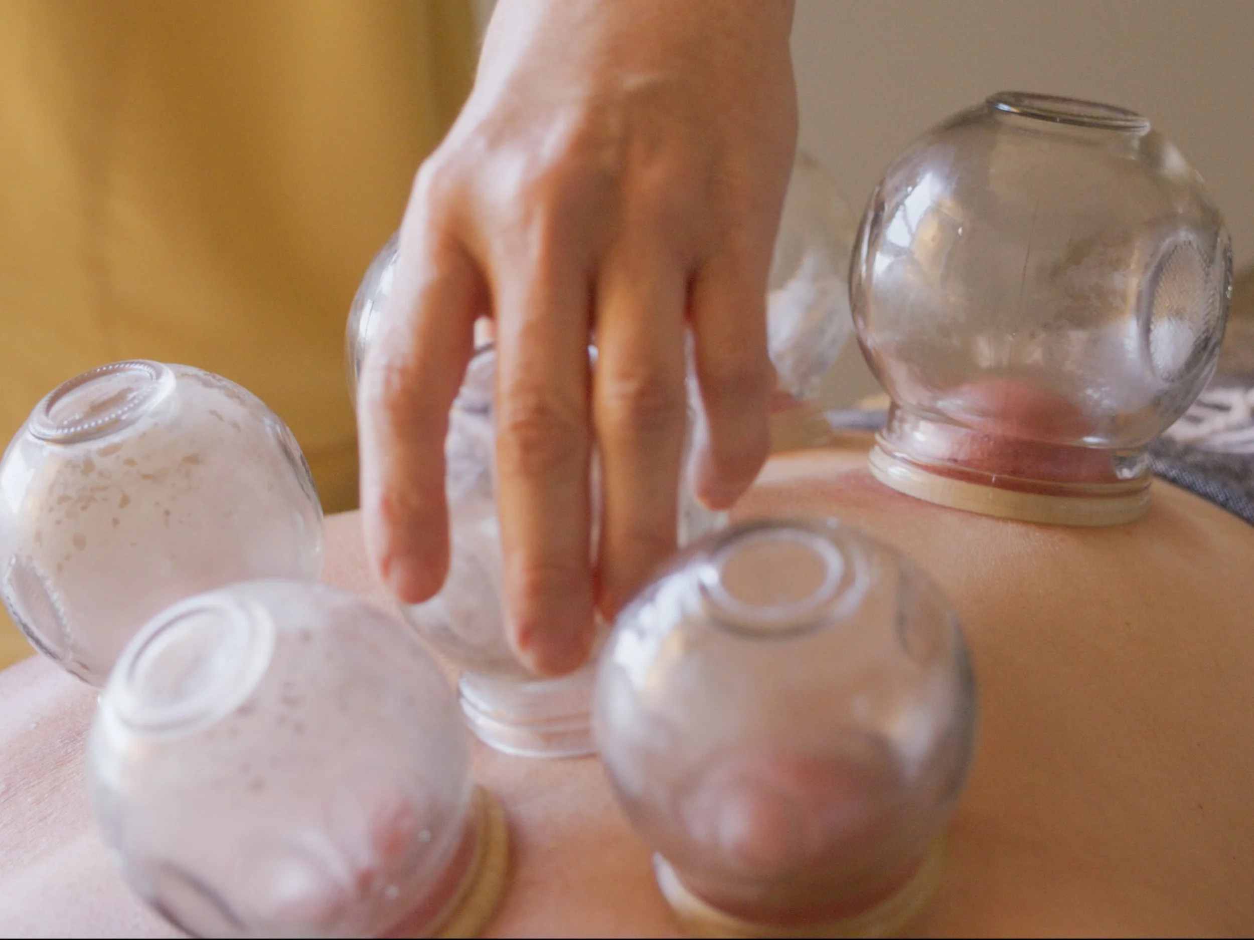 Cupping edited photos-12.jpeg