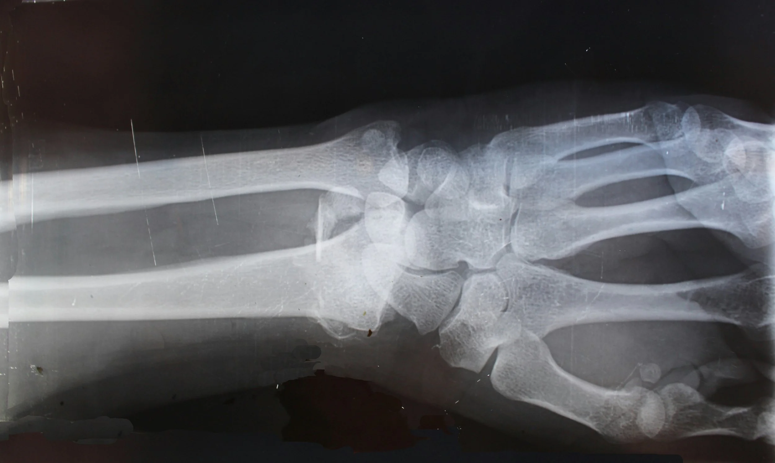 Do I need an X-ray after an injury?