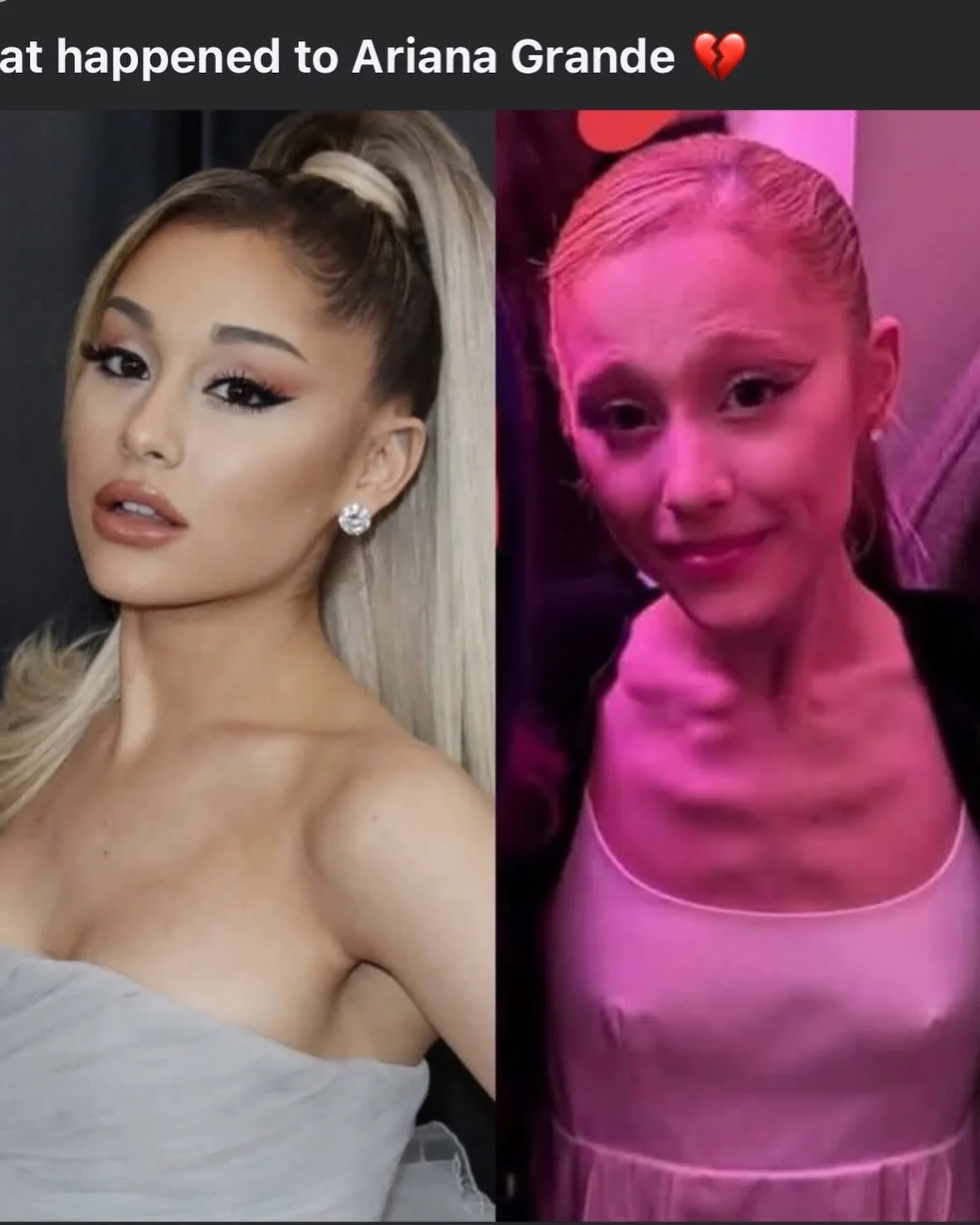 This weight loss or anorexia could be  Graves disease (hyperthyroidism) overactive thyroid hormone from chronic stress and anxiety. It causes insufferable agression and mood swings and most killers have been found to have it, what causes them to tran