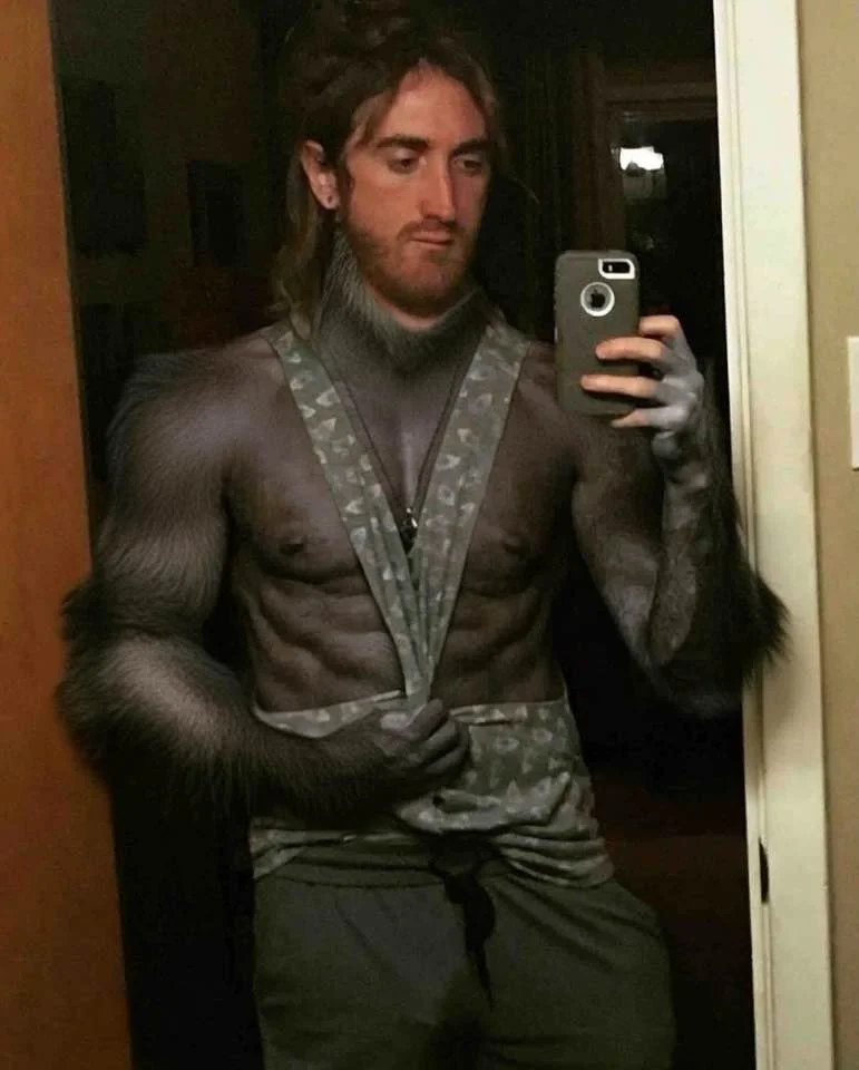 Oh no! I caught the monkey pox from the obamas! 🦍🤣