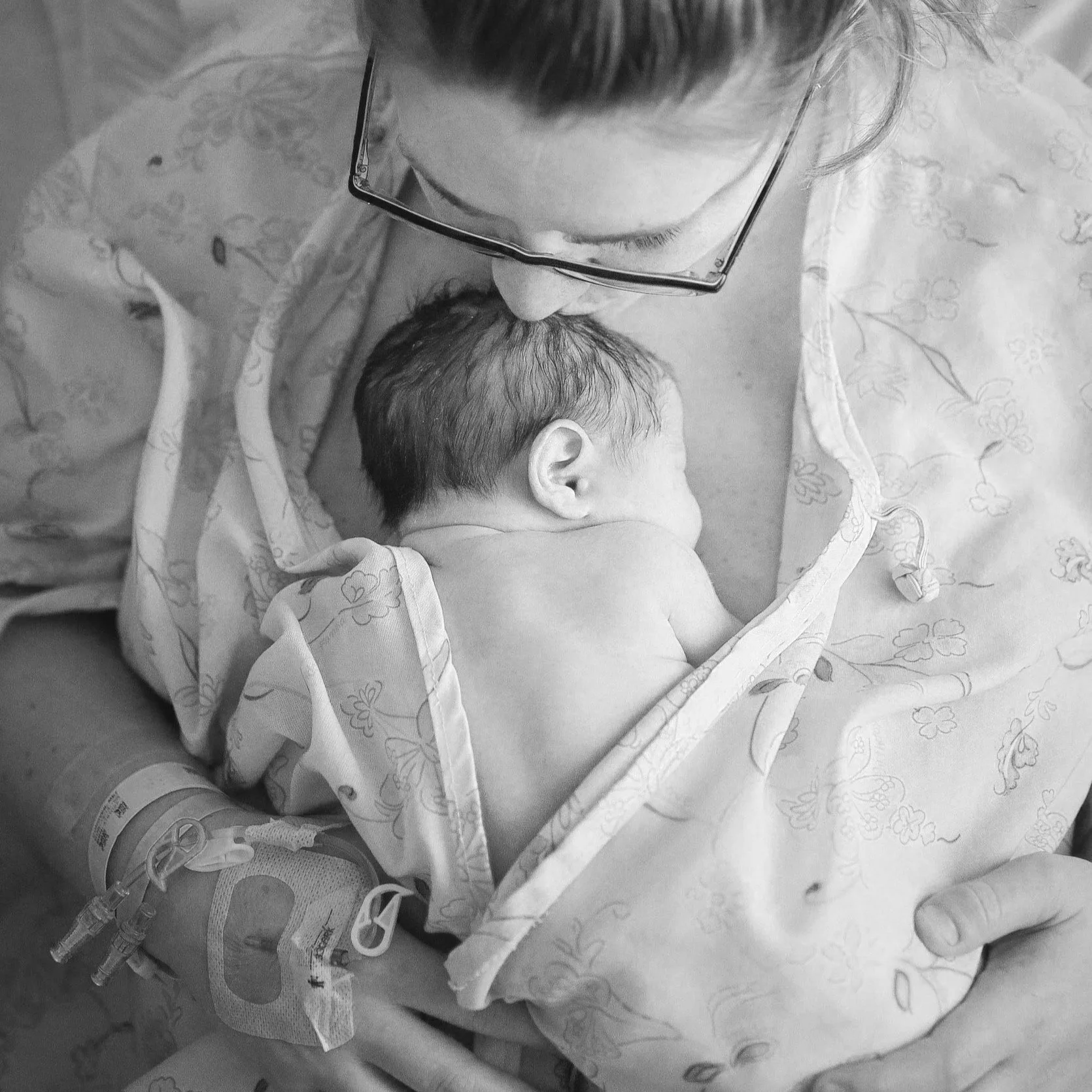 Engorgement treatment;