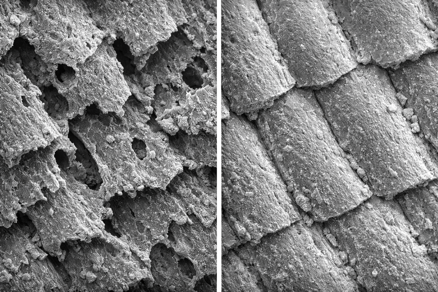 Scanning electron microscope (SEM) image showing nano-hydroxyapatite crystals integrated into tooth enamel, illustrating biomimetic remineralization at the microscopic level.