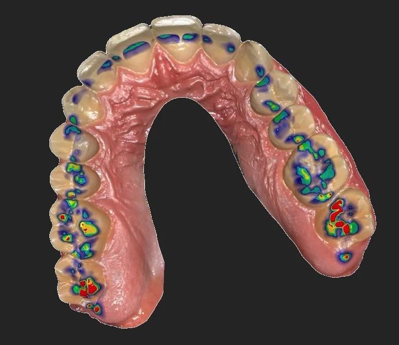 3D Digital Intraoral Scanning | Advanced Dental Imaging | David R ...