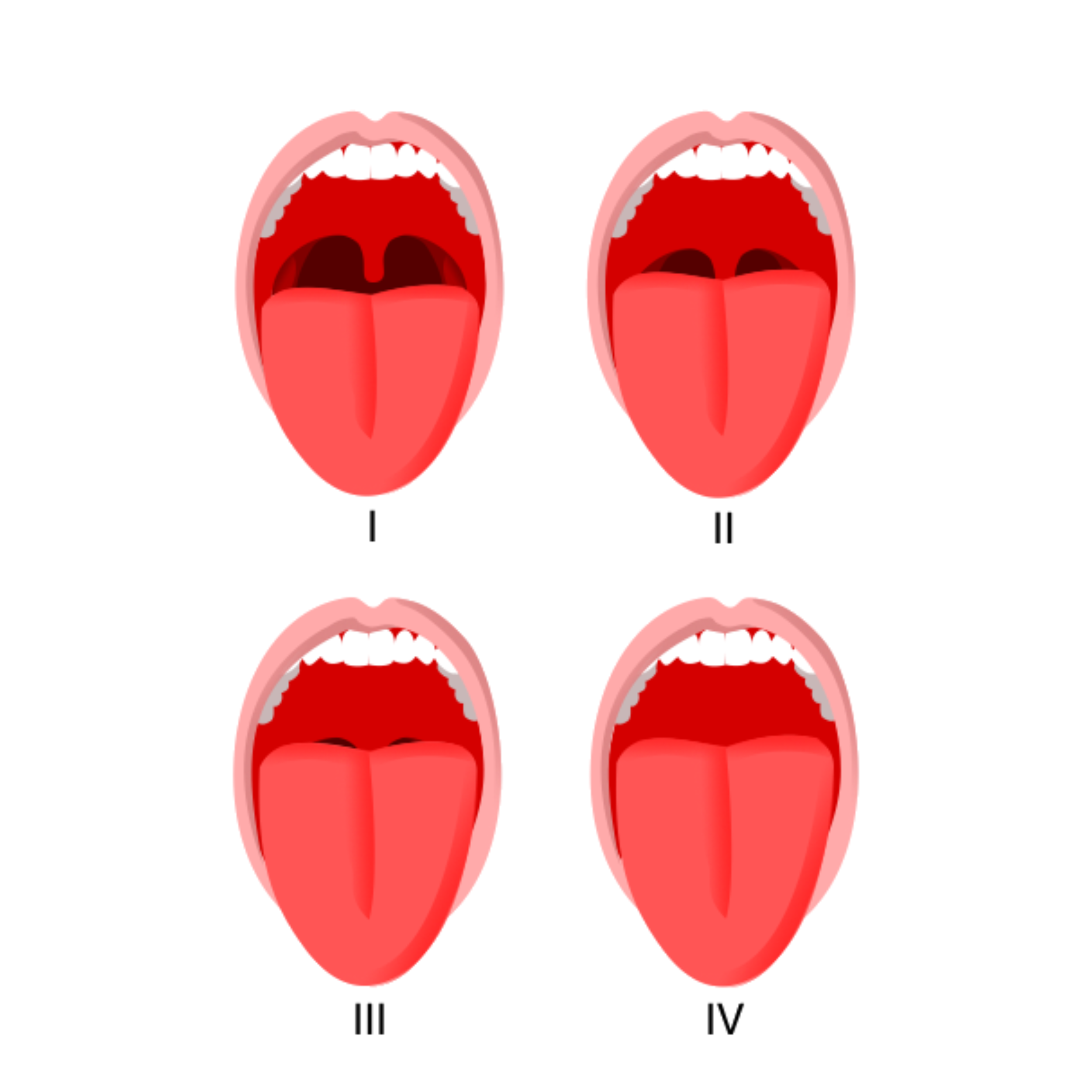 Mallampati -score.png