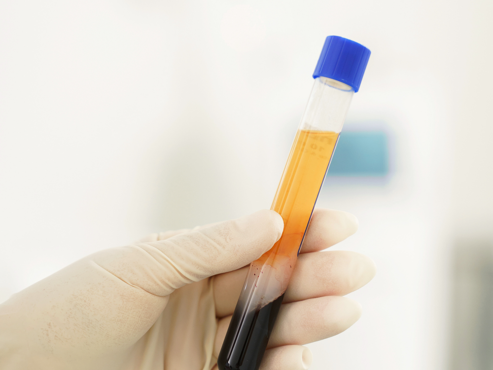 Prolotherapy & PRP Treatment — Krell Wellness Center