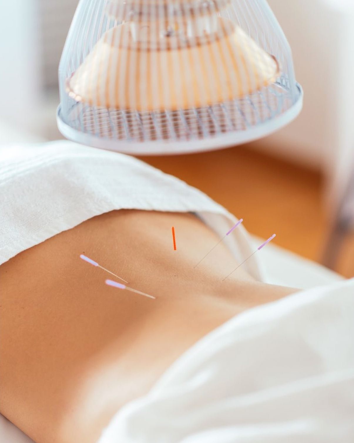 Acupuncture has been practiced in China for thousands of years. Chinese medicine practitioners believe the human body has more than 2,000 acupuncture points. These points are linked through meridians or energy channels.  The use of these points impro