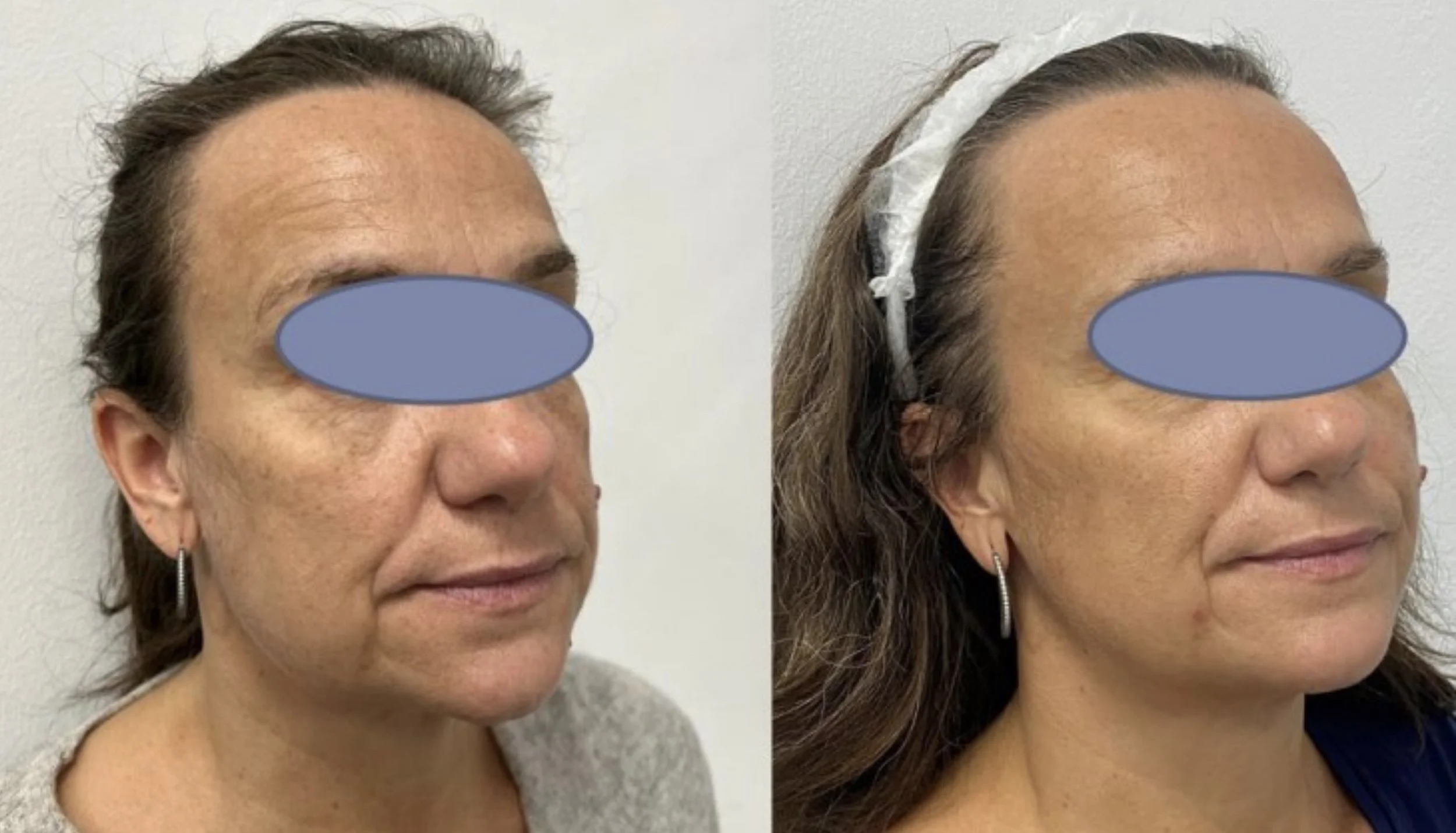 Polynucleotides with lifting effects.