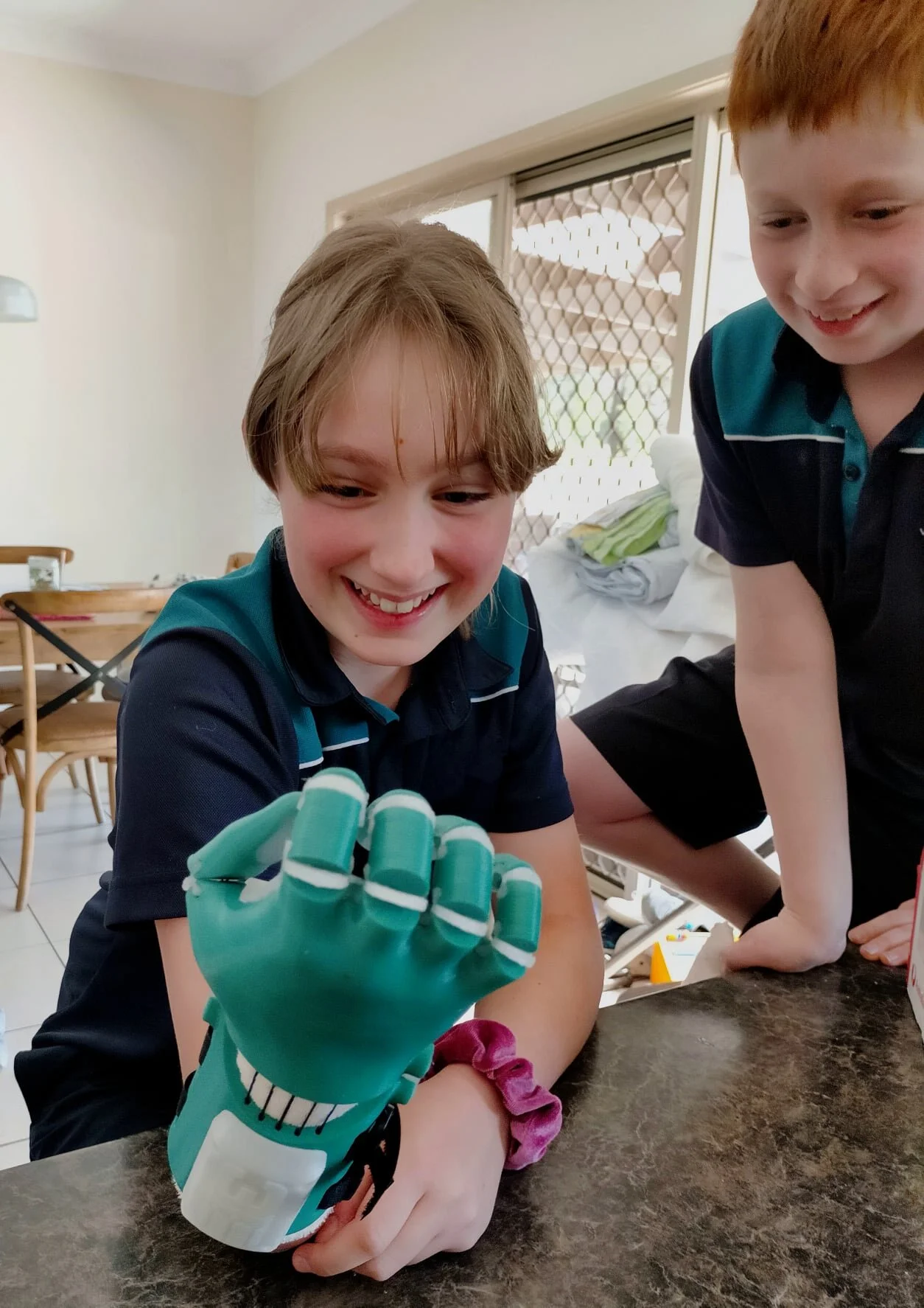 A prosthetic hand designed and printed by the e-NABLE community