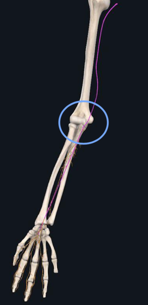 Median Nerve Passing through Cubital Tunnel