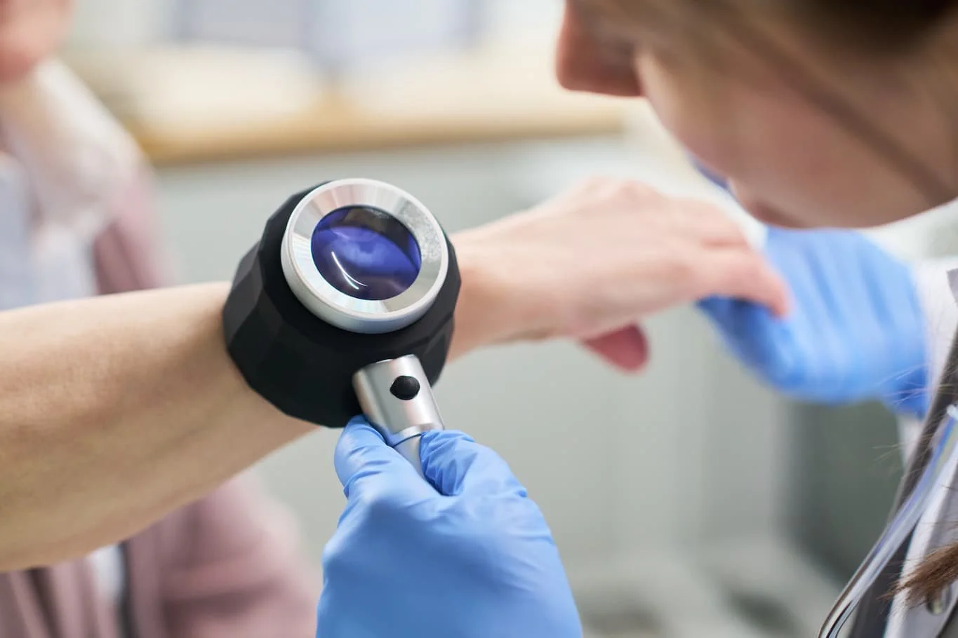 Where to get a skin cancer screening in Milwaukee
