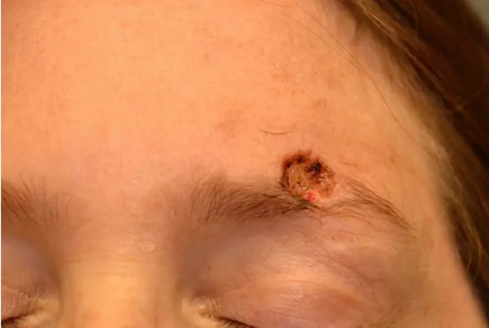 From Fear to Hope: Emma's Story with Dr. Dika