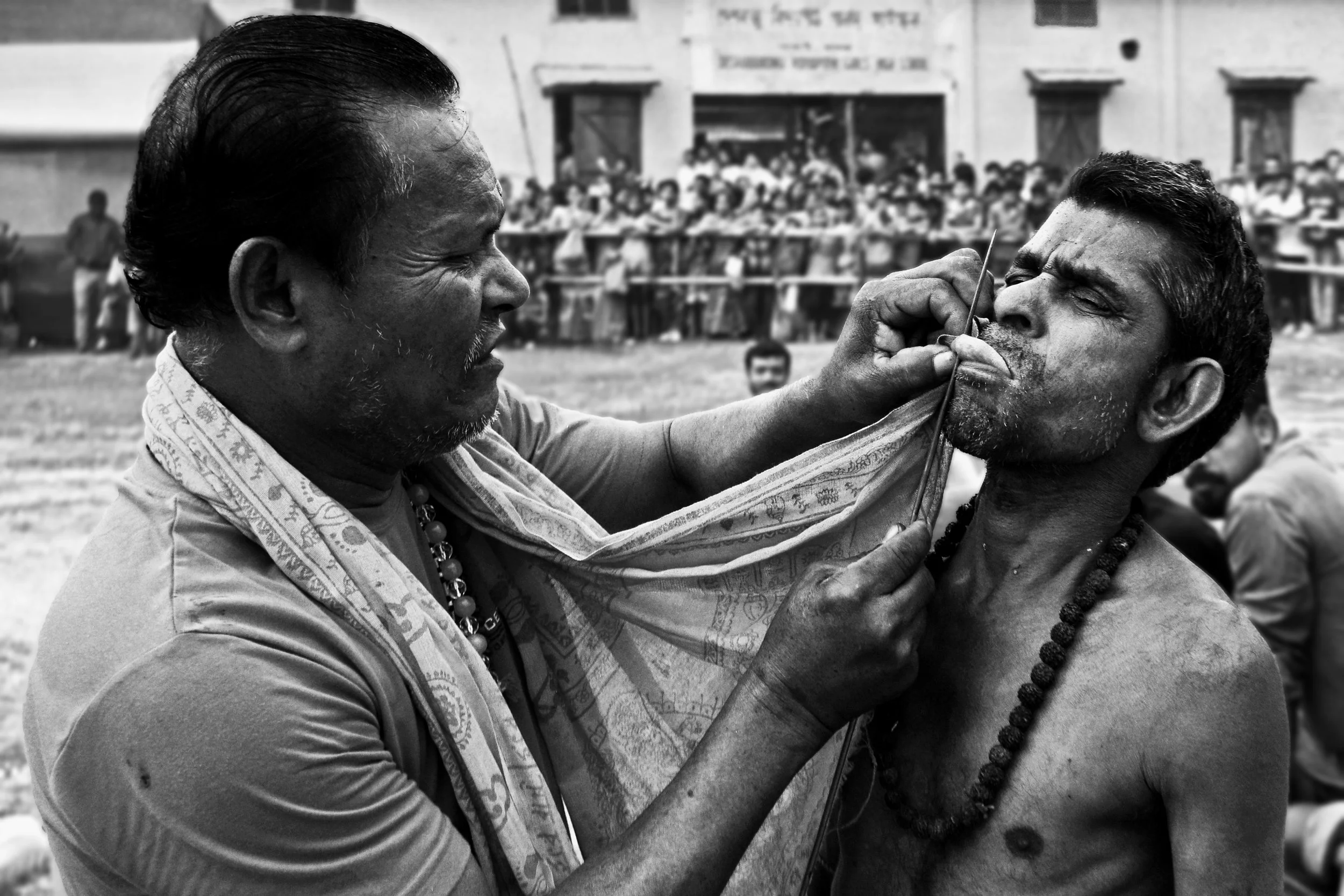 Prateek Agarwal / India / Bearing the pain