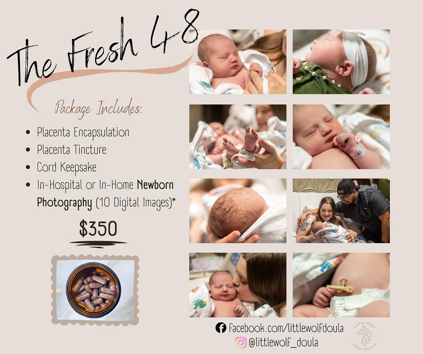 Introducing.... The ✨ Fresh 48 ✨ Package!!

I am SO excited about this package! It includes:

🌙 In-Hospital or In-Home Newborn Photography (10 Digital Images)
🌙 Placenta Encapsulation
🌙 Cord Keepsake
🌙 Placenta Tincture

Pickup of placenta and de