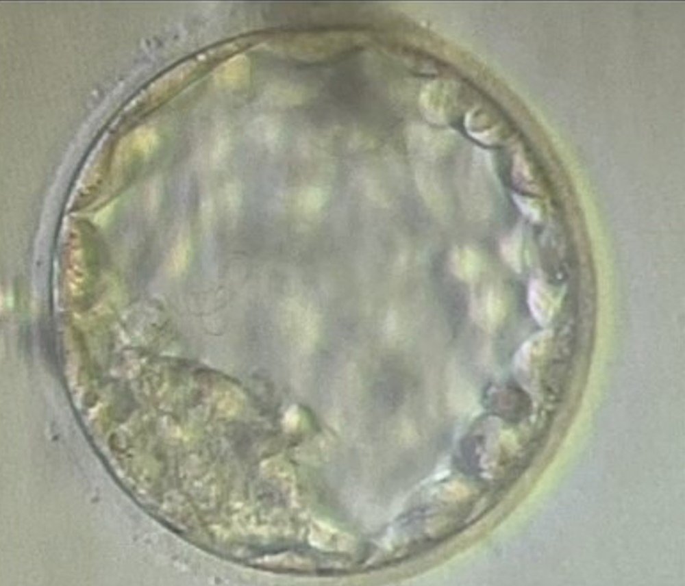 Good quality embryo.jpg