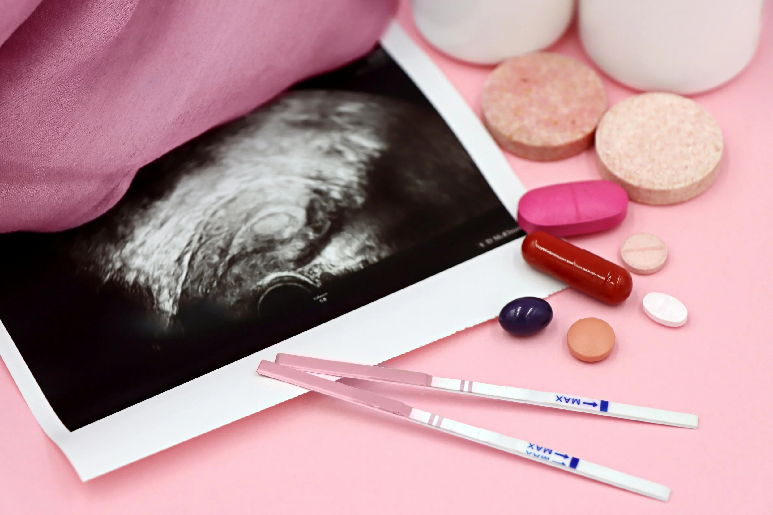 An ultrasound printout partially covered by scattered pills, including pink tablets, a red capsule, and blue and beige pills, on a pink surface.