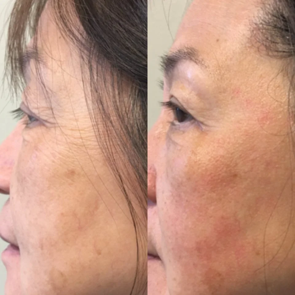 Ultimate Eye Upgrade