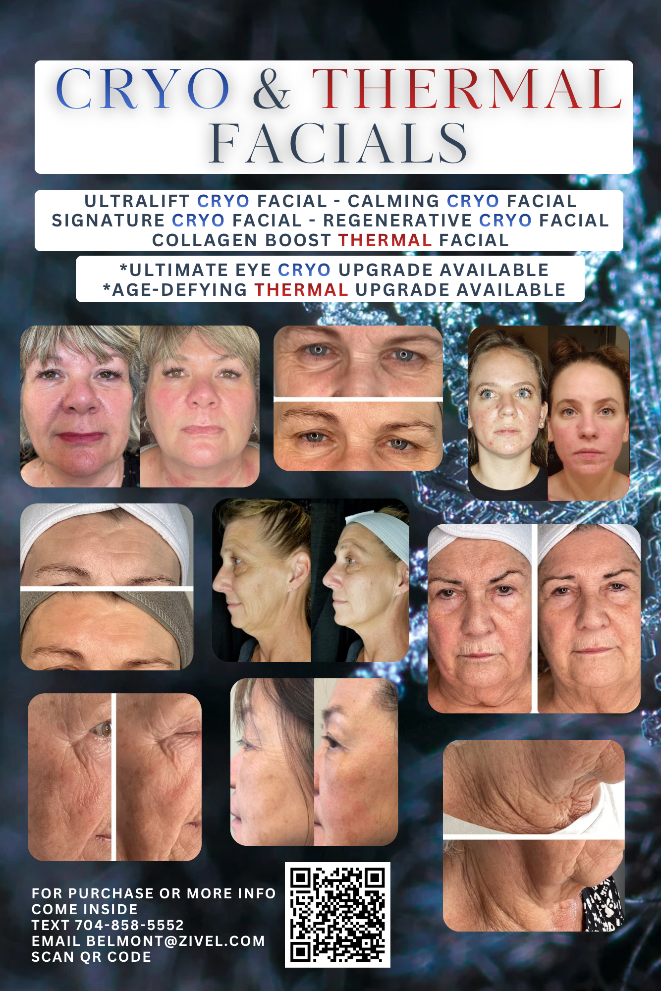 Copy of CRYO & THERMAL FACIALS (12 x 18 in).png
