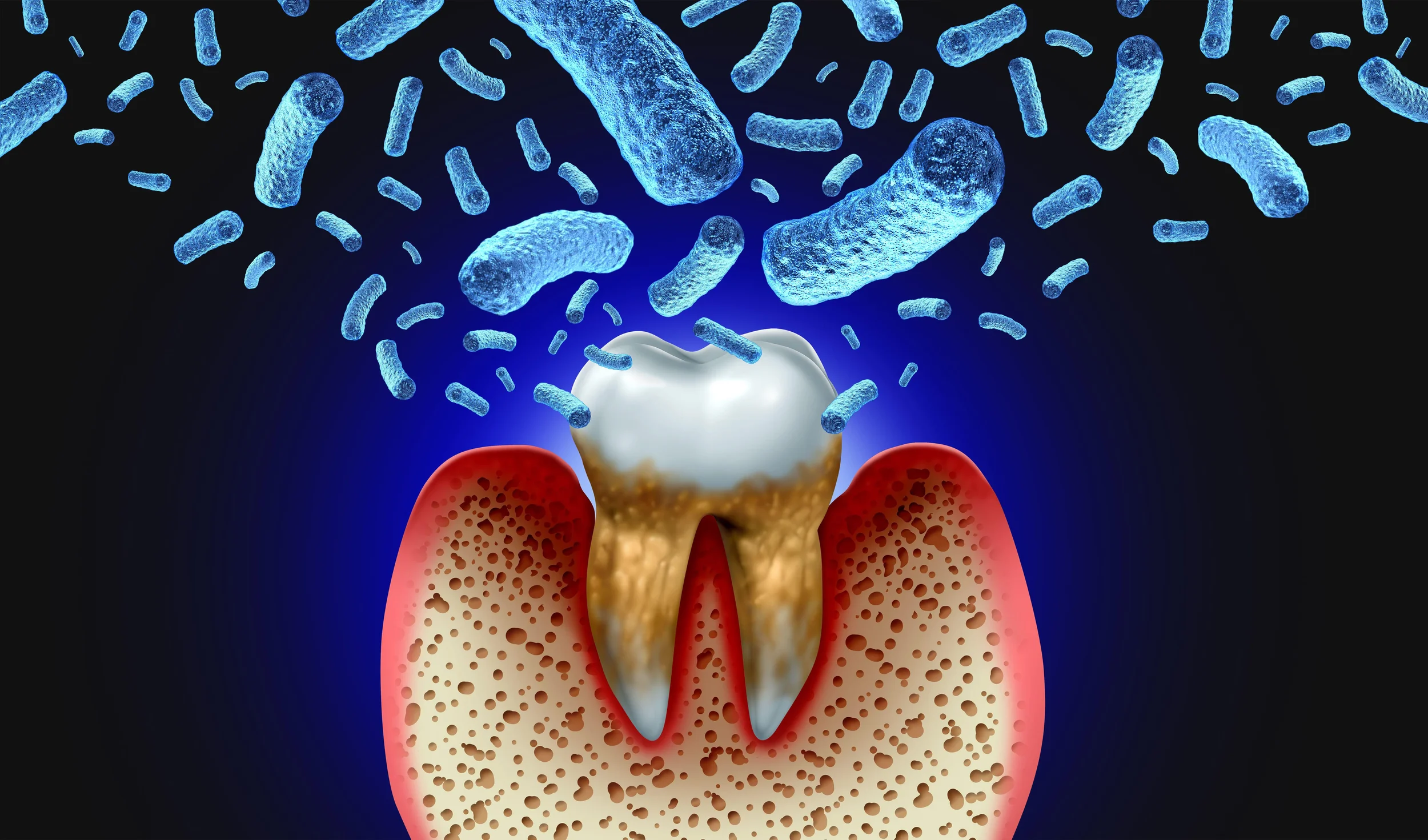 Signs of Tooth Infection Spreading