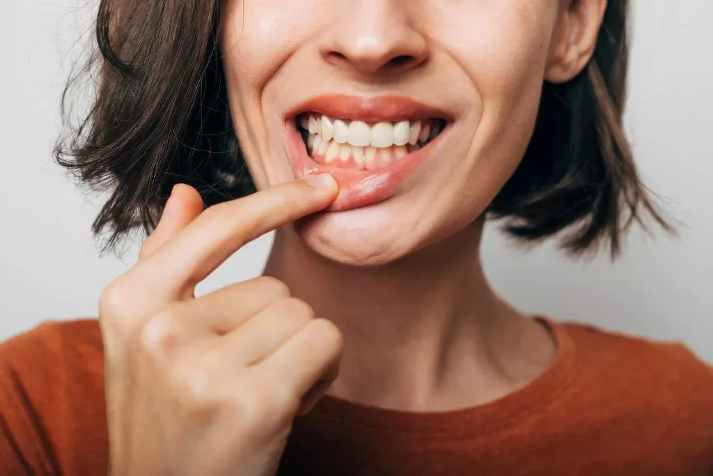 Bleeding Gums Without Pain — Should You Be Concerned?