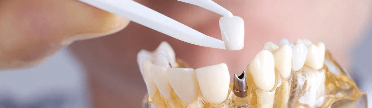 Why Does My Crown Feel Too High?