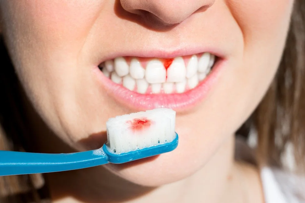 Early Signs of Gum Problems in Teens