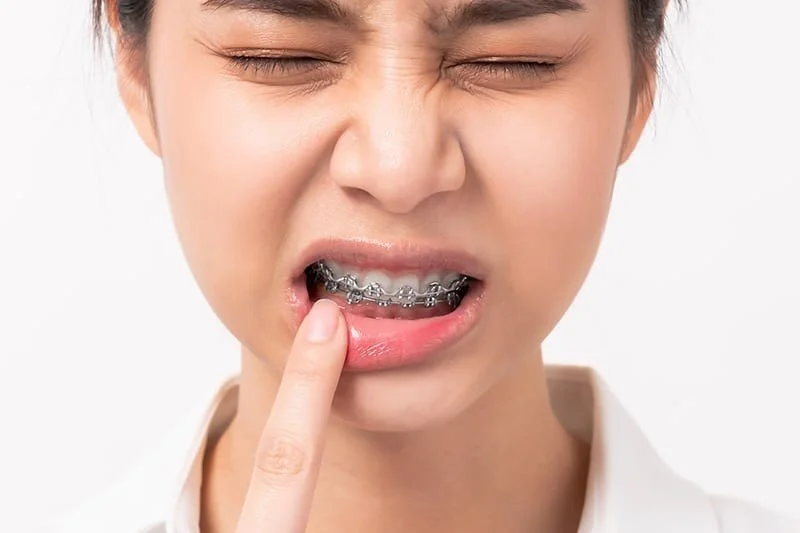 How Orthodontic Issues Affect Facial Development