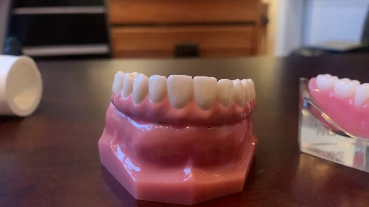 Full Mouth Dental Implant Success: What Westfield Patients Should Know in 2026