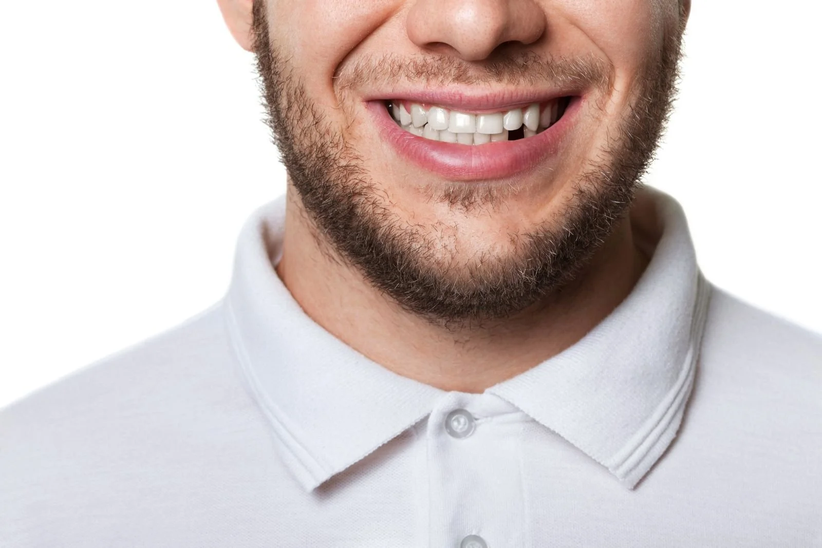 Can Missing Teeth Change the Shape of Your Face​?