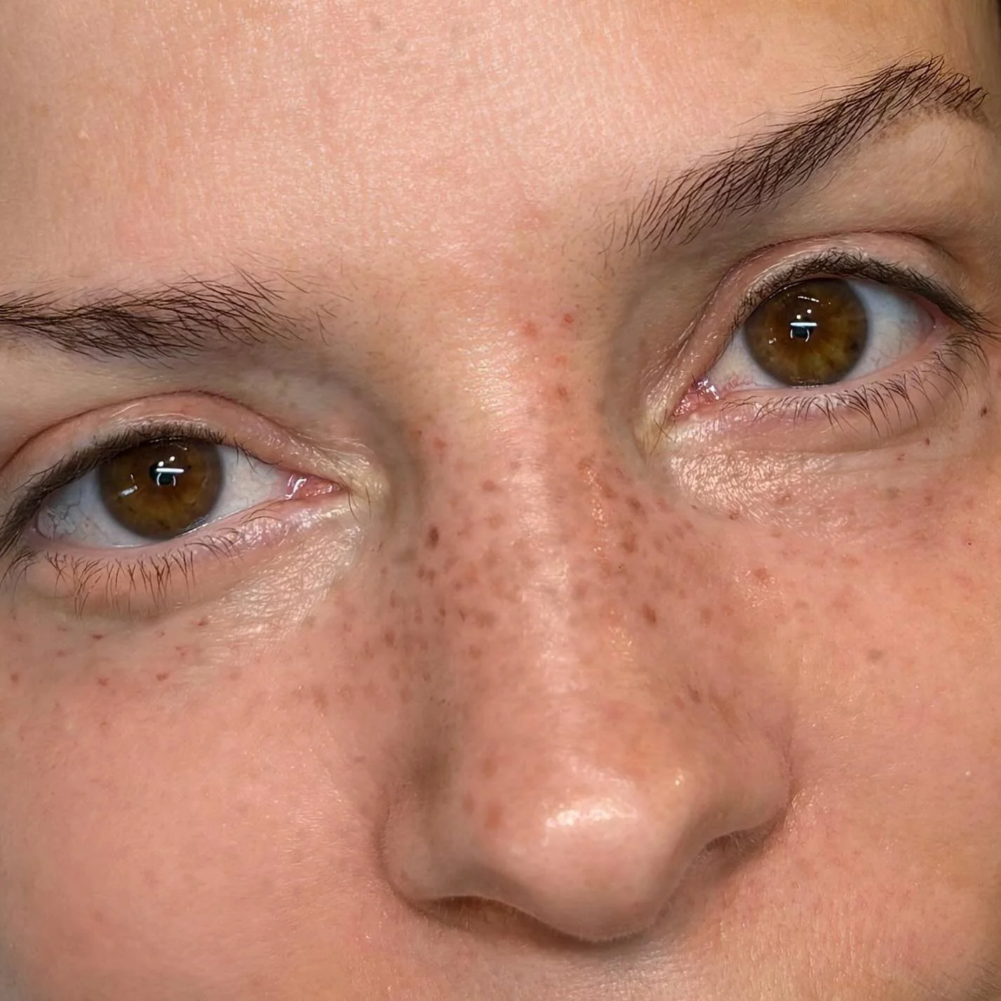 De belles taches de rousseur, subtilement pigment&eacute;es,
juste ce qu&rsquo;il faut pour un effet soleil 🌞