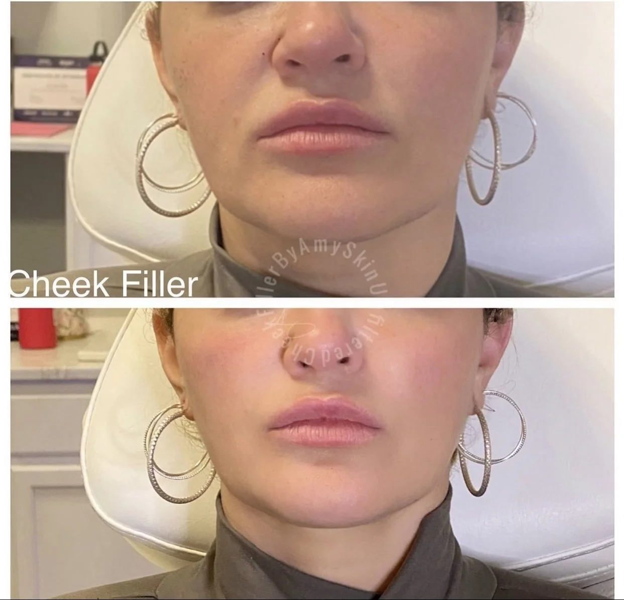 Botox®, Dermatology, Weight Loss, and More Serving Ellensburg and Yakima