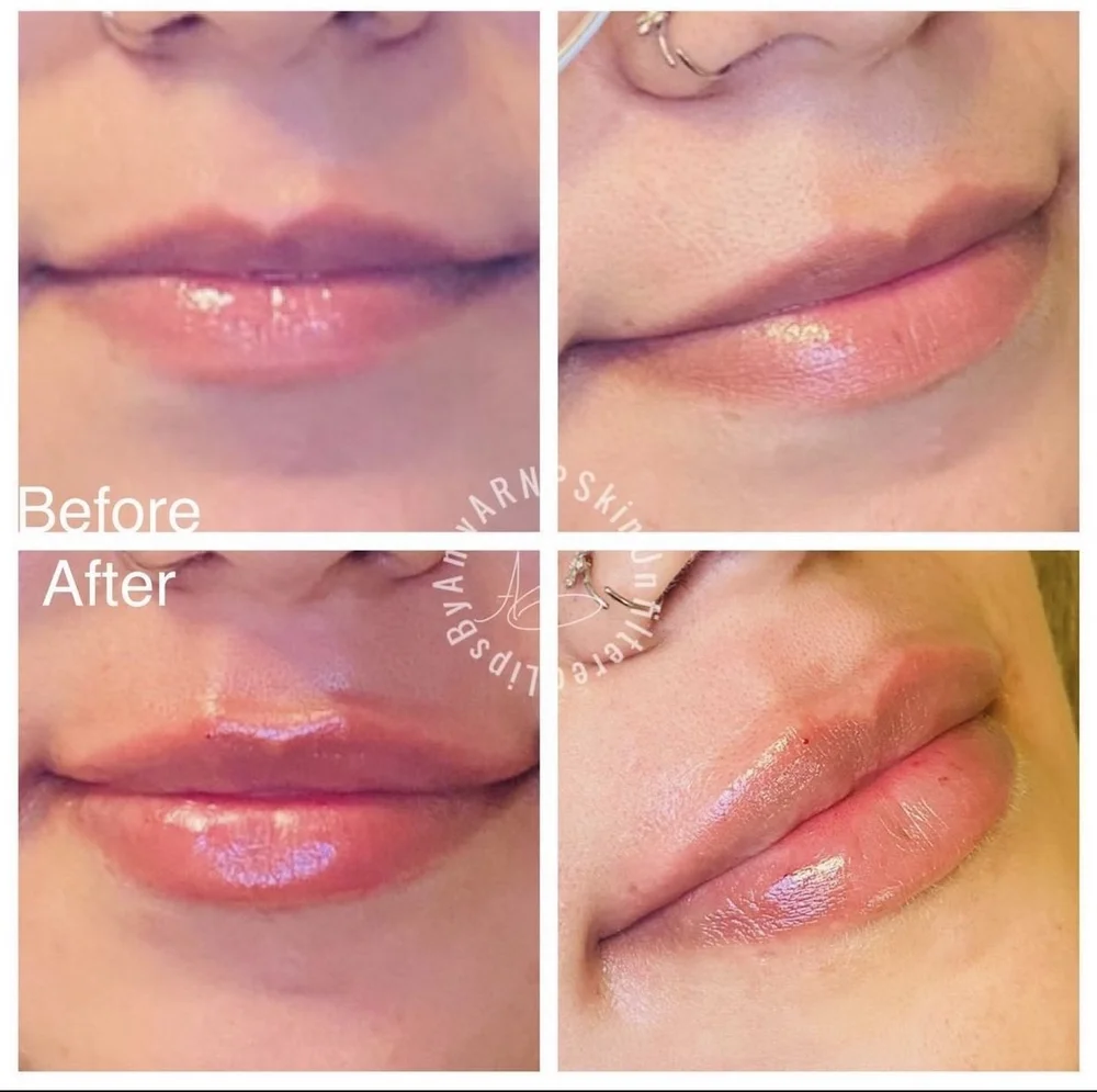 Botox®, Dermatology, Weight Loss, and More Serving Ellensburg and Yakima