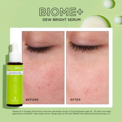 BIOME_-DEW-BRIGHT-SERUM-PDP-R08_1024x_e74a64e9-462b-455f-999b-c5a05f1221fd_400x.jpg