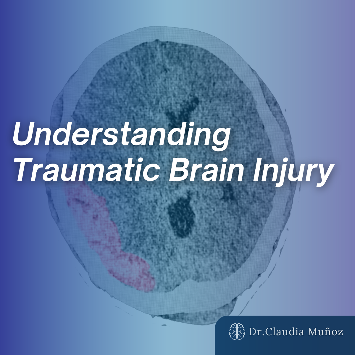 Understanding Traumatic Brain Injury: Why Expert Witnesses Matter