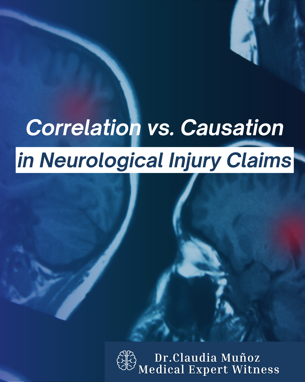 Correlation vs. Causation in Neurological Injury Claims