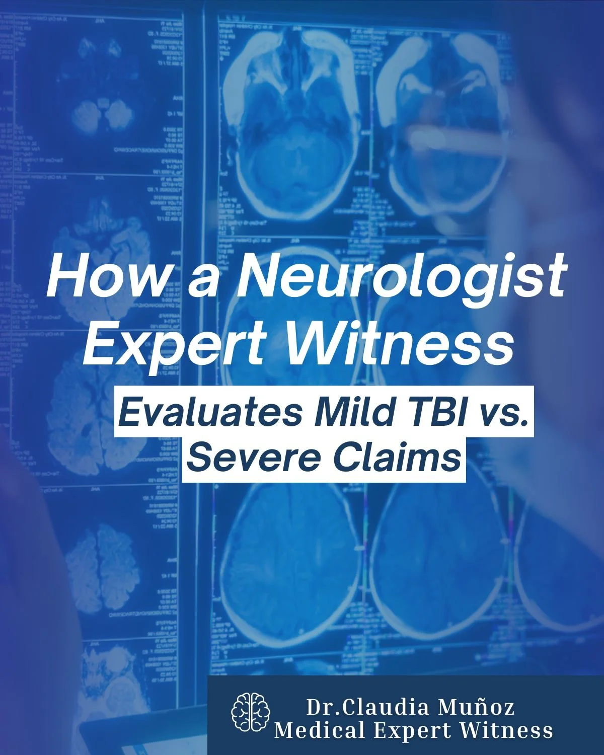 How a Neurologist Expert Witness Evaluates Mild TBI vs. Severe Claims
