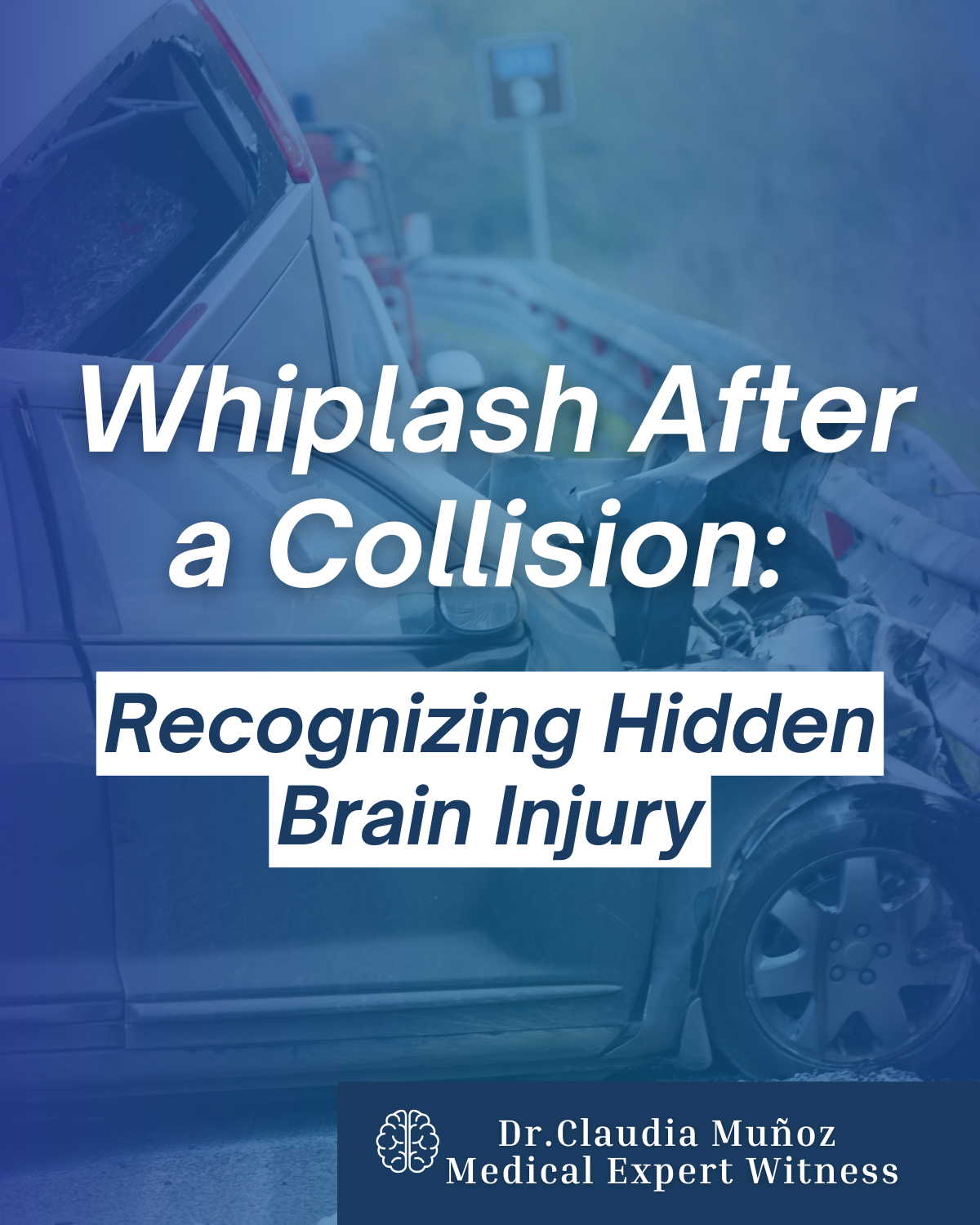 Whiplash After a Collision: Recognizing Hidden Brain Injury