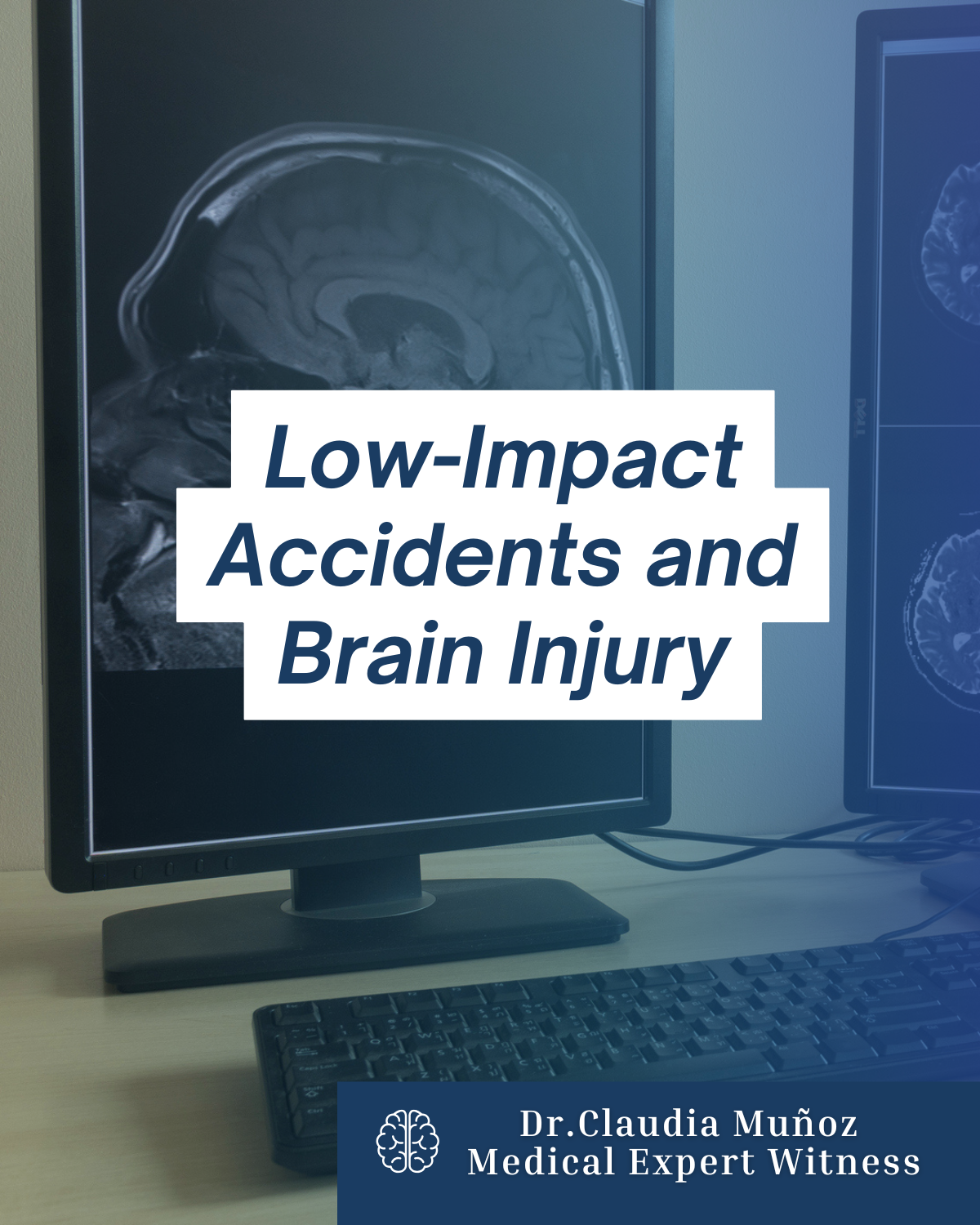 Low-Impact Accidents and Brain Injury