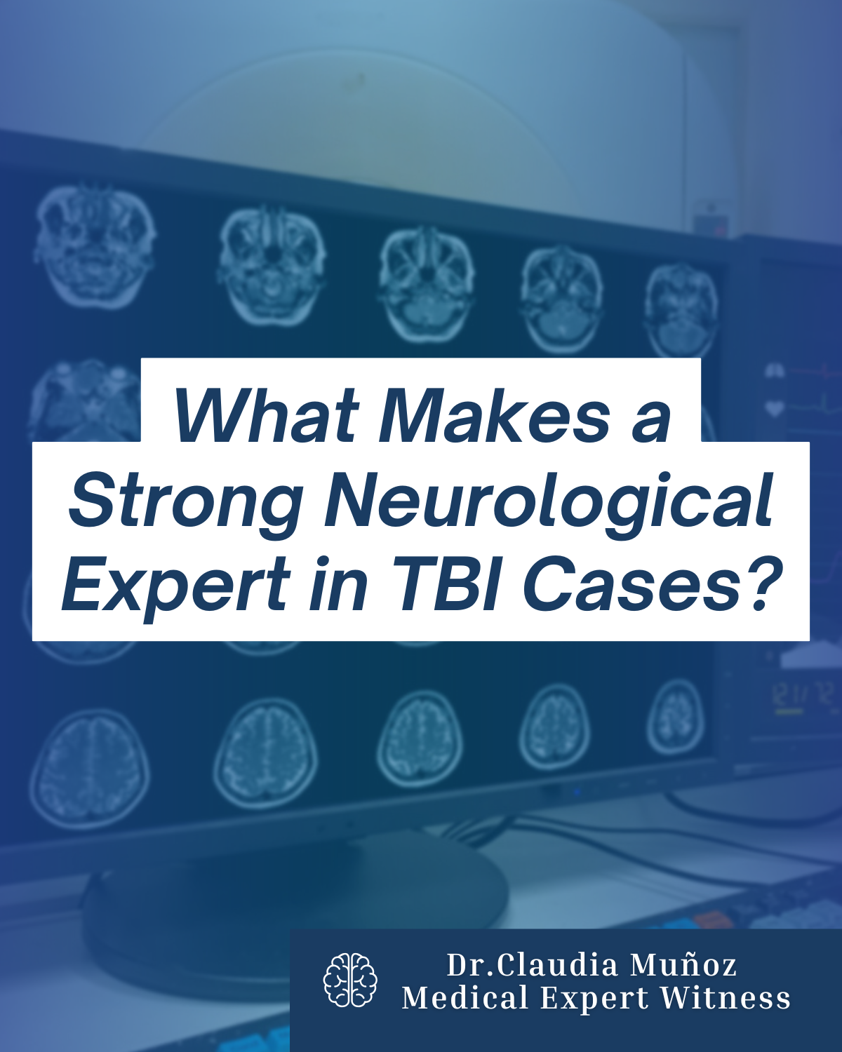 What Makes a Strong Neurological Expert in TBI Cases?