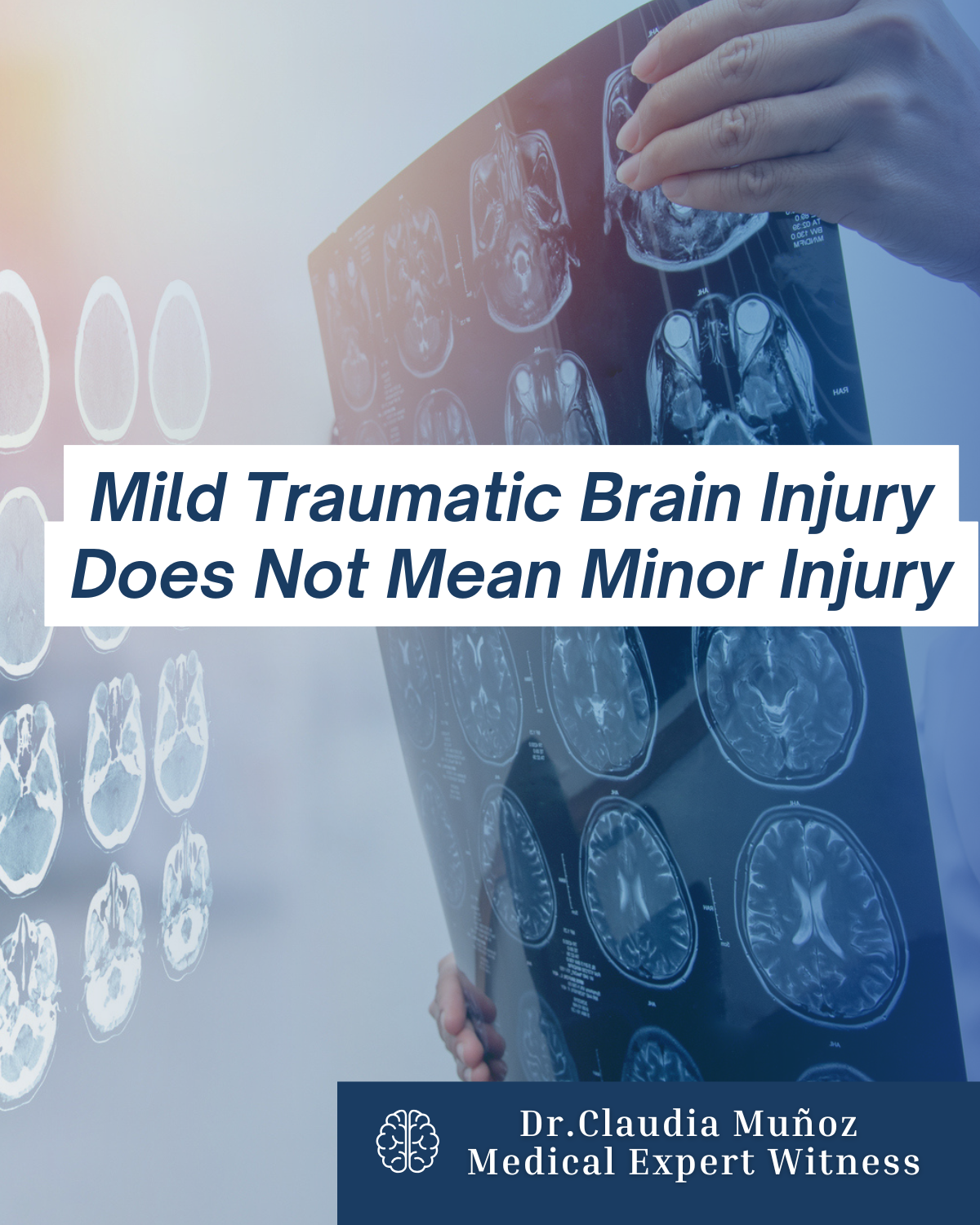 Mild Traumatic Brain Injury Does Not Mean Minor Injury
