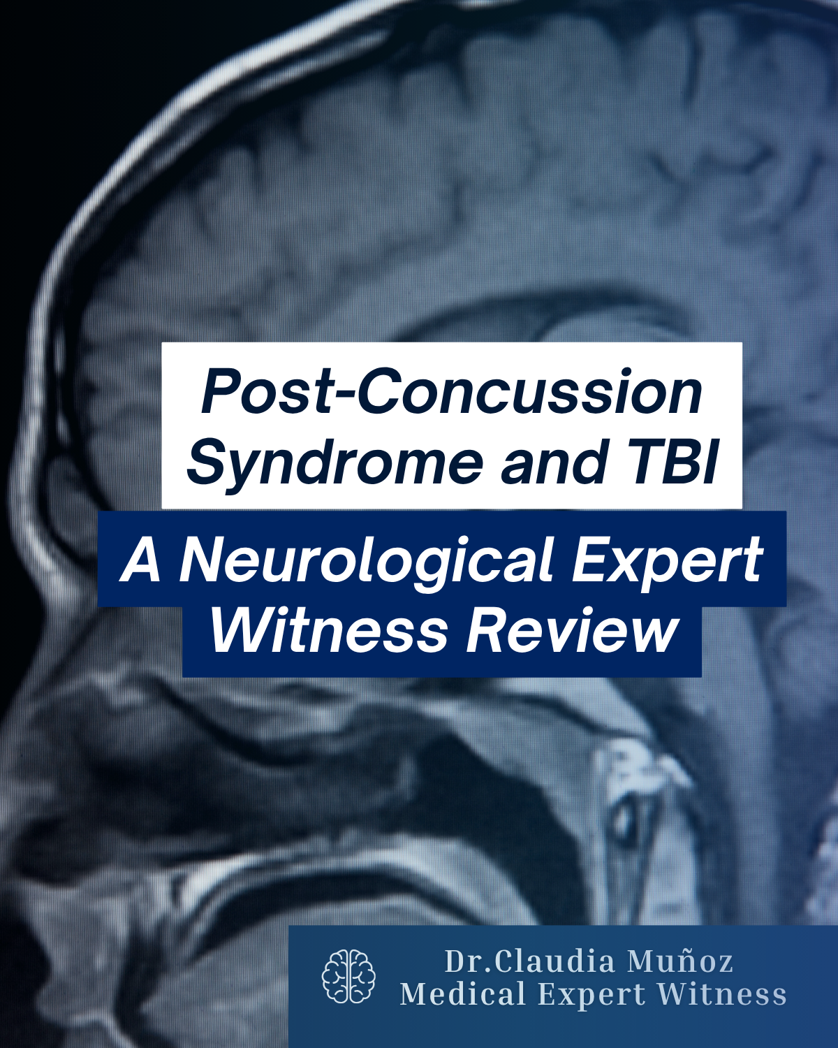 Post-Concussion Syndrome and TBI: A Neurological Expert Witness Review