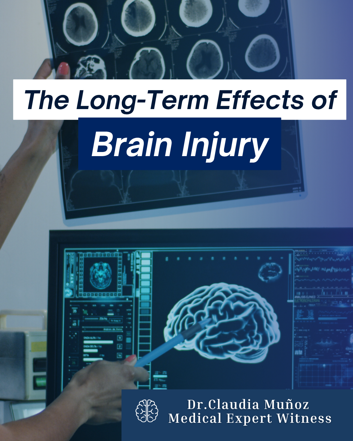 The Long-Term Effects of Traumatic Brain Injury