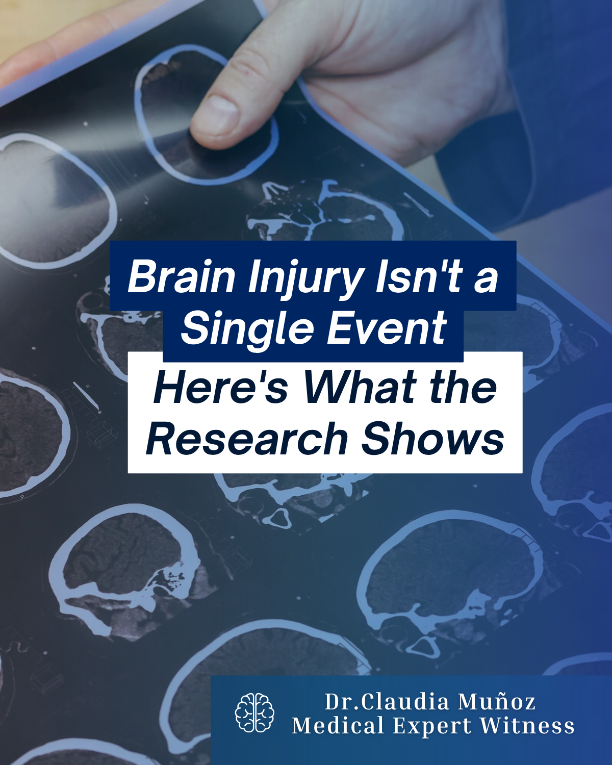 Brain Injury Isn't a Single Event